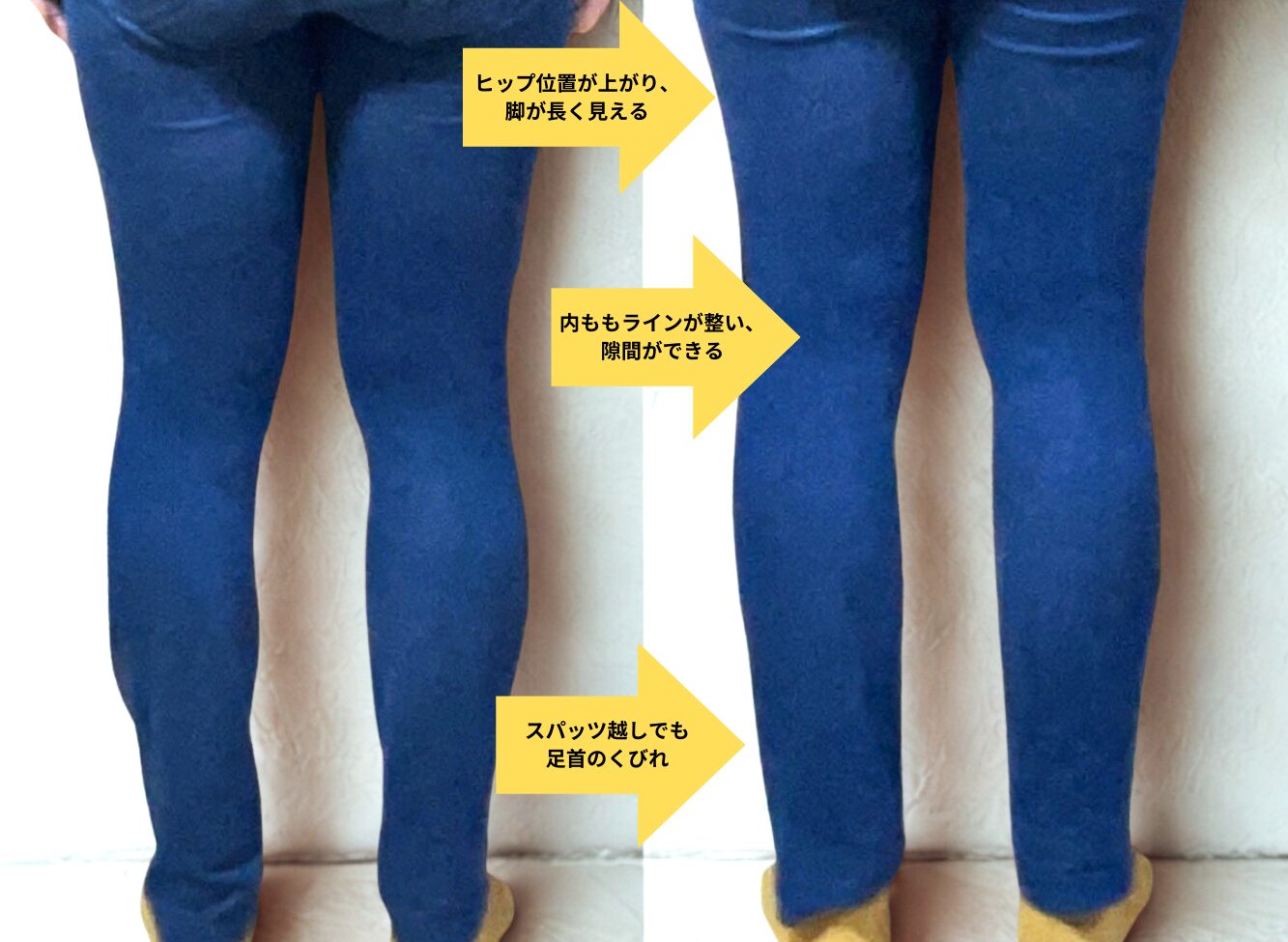 むくみを流しても脚がすらりと見えない原因と変化例